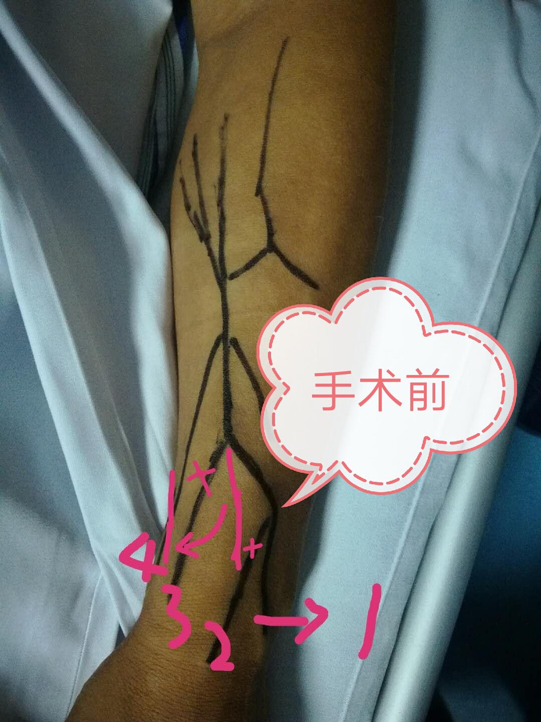 1534382662365593.jpg 血透室手术1.jpg