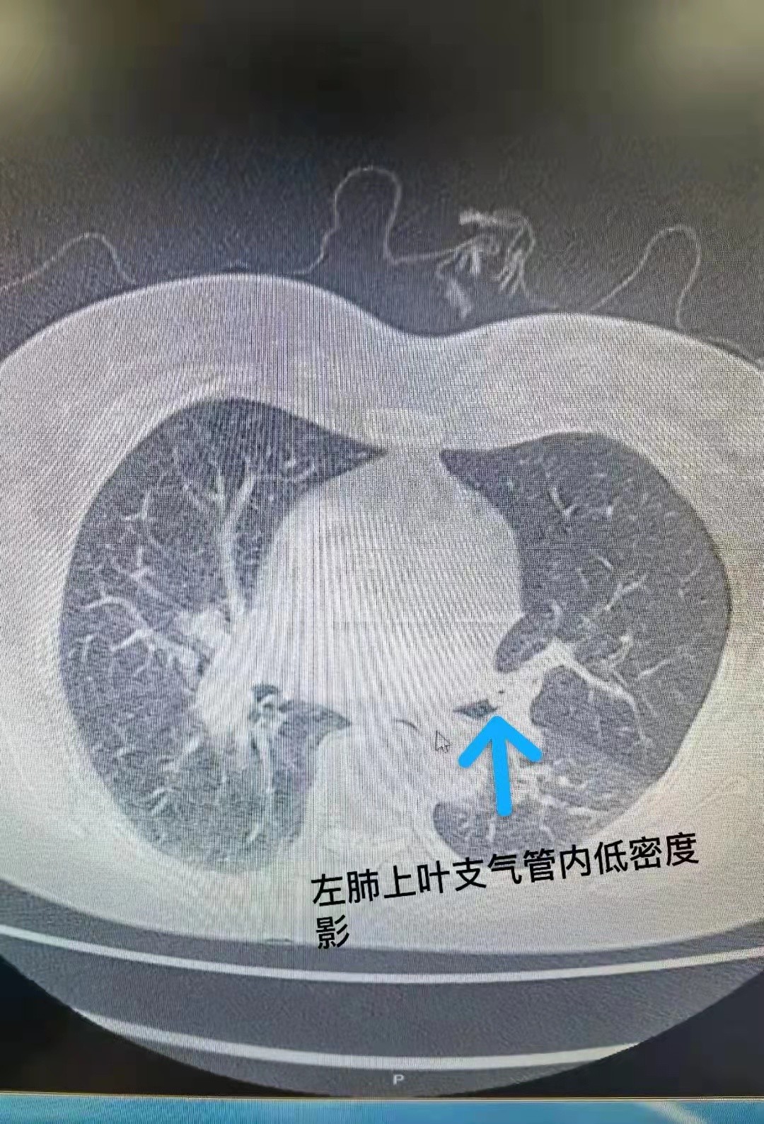 1648006252289704.jpg 微信图片_20220322162640.jpg